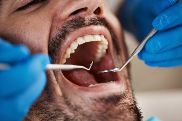 Oral Cancer Screening in Bell Gardens, CA